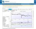 70803 : Logiciel de bourse gratuit : La bourse avec l'analyse technique et les chandeliers japonais